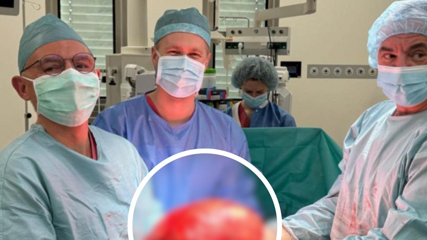 Lekarze usunęli 14-kilogramowego guza nerki. "Uciskał kluczowe organy pacjenta"