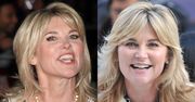 Anthea Turner: traci rysy? Coraz bardziej perfekcyjna (i niepokojąca) twarz