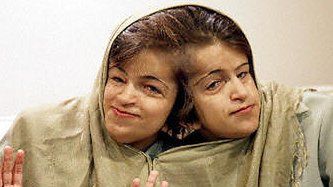 Siostry przed operacją