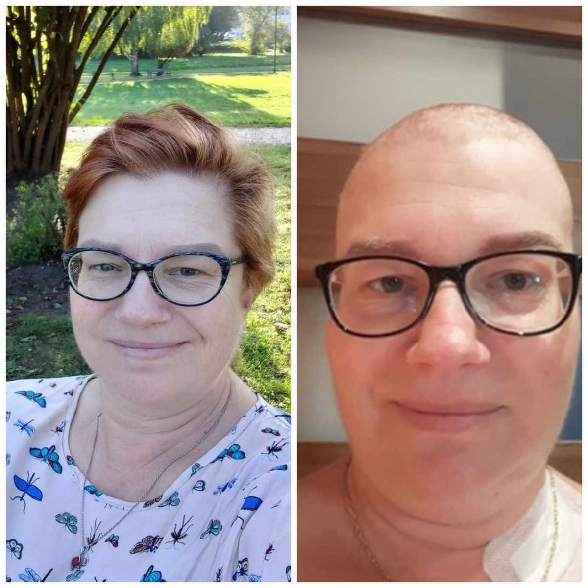 Dla pani Ewy Enhertu jest jedyną opcją leczenia