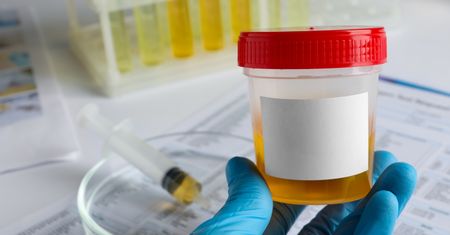 Nefropatia hipokaliemiczna – przyczyny i inne objawy niedoboru potasu