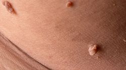 Vericaust - skład, działanie, stosowanie i przeciwwskazania