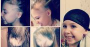 7-latka w miesiąc straciła wszystkie włosy. Mama znalazła rozwiązanie na pozbycie się jej kompleksów