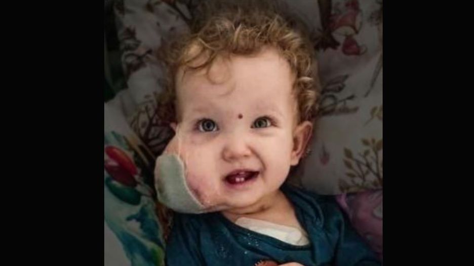 Dziewczynka upadła na policzek. Diagnoza okazała się druzgocąca