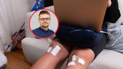 Ostrzega o zatkaniu żył i zakrzepicy. "Objaw alarmowy numer jeden"