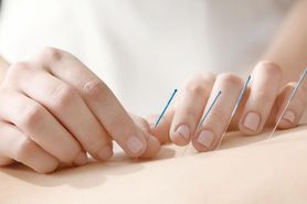 Akupunktura może złagodzić kolkę u niemowląt