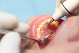 Ile kosztuje leczenie stomatologiczne?