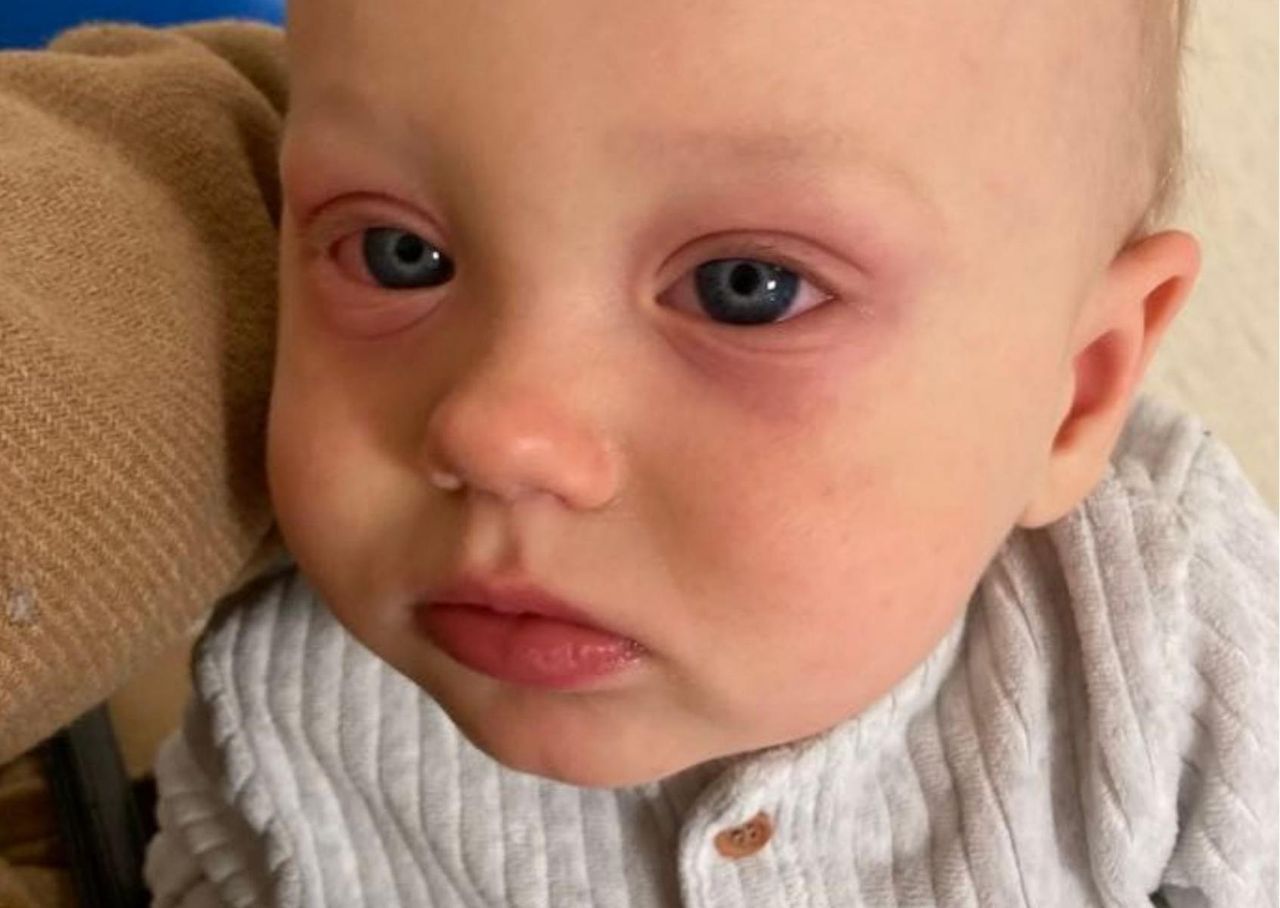 Taki może być efekt braku testów. Nie będziemy kojarzyć groźnych powikłań z wirusem