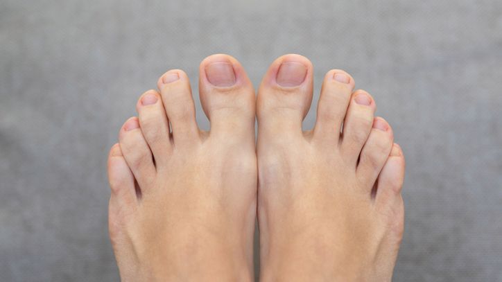 Po paznokciach u stóp poznasz, że masz problemy z cholesterolem