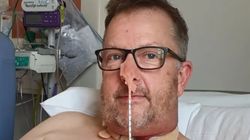 Myślał, że chrypkę powodują polipy na strunach głosowych. Lekarz odkrył, że to złośliwy nowotwór