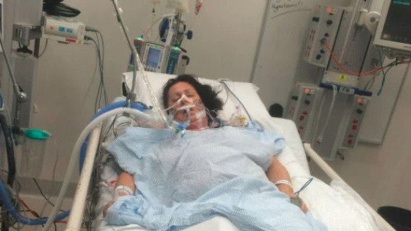 Jodie po opracjach usunięcia skóry i mięśni