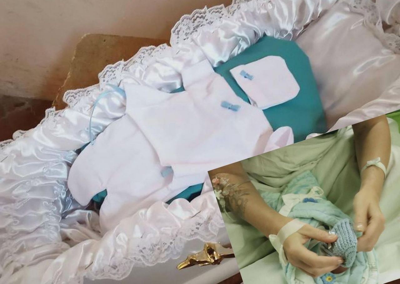 Urodziła martwe dziecko z zespołem Edwardsa. Wydali ciało w "niebieskim worku"