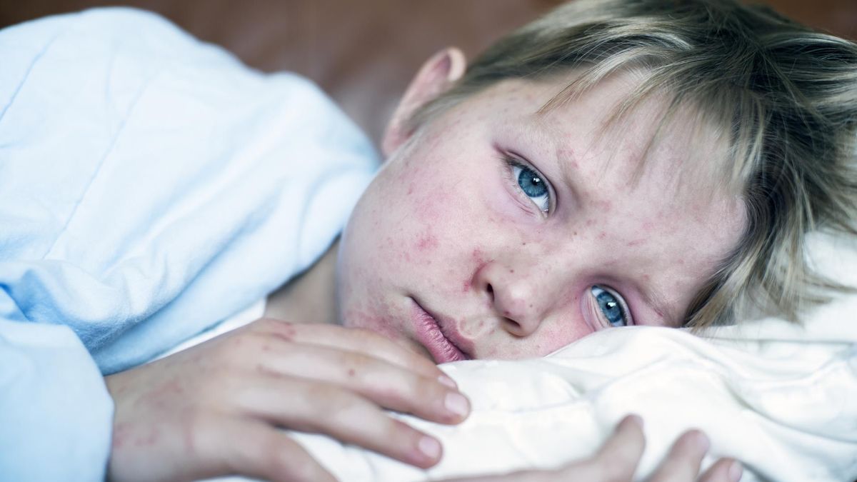 Na odrę mogą zapaść zarówno dzieci, jak i osoby dorosłe.