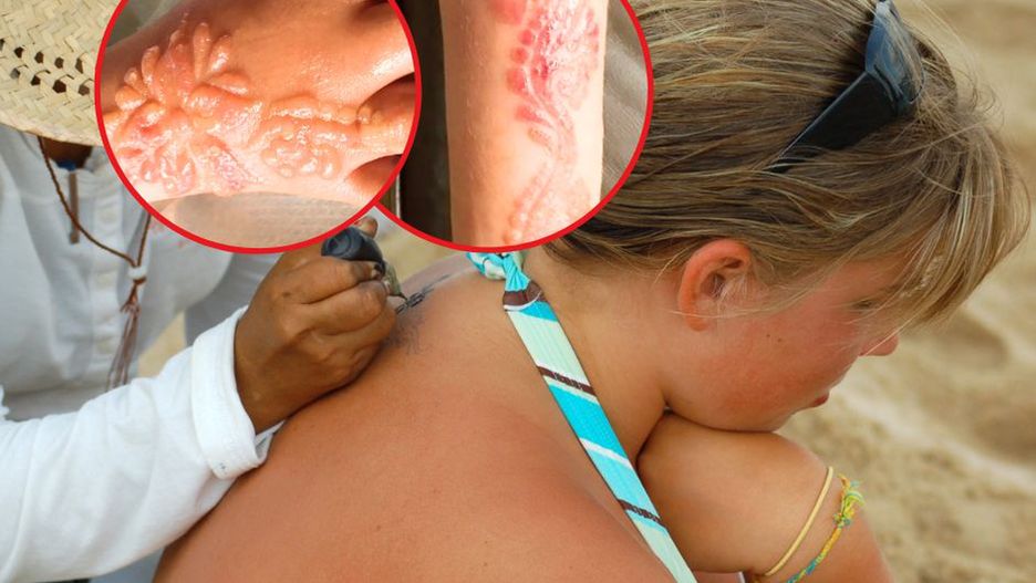 GIS ostrzega przed tatuażami z henny. Może się naprawdę źle skończyć