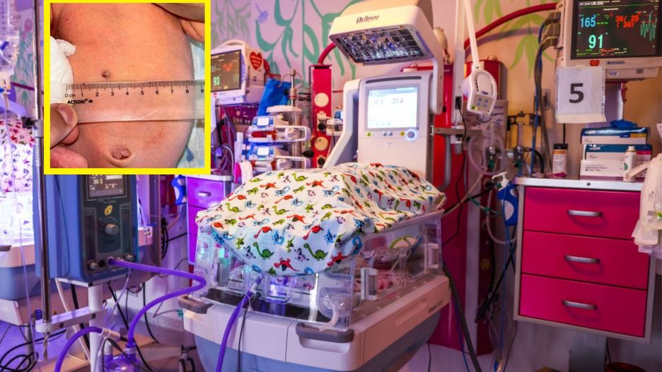 Dziecko urodziło się z kulą w brzuchu. Ojciec postrzelił ciężarną matkę z wiatrówki