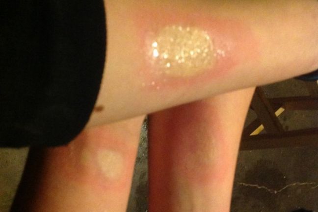 Salt and ice challenge to wyzwanie popularne w Wielkiej Brytanii 