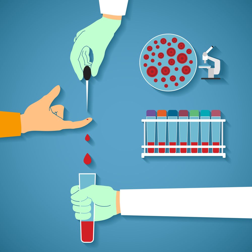 Płytki krwi - wskazania i przebieg badania PLT, interpretacja wyników