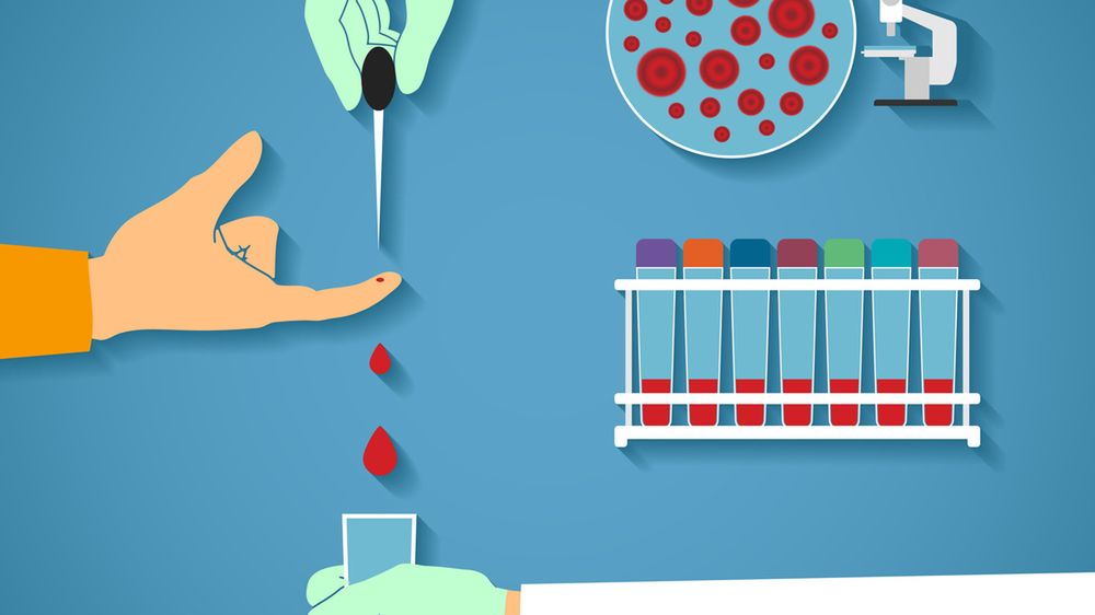 PLT to oznaczenie poziomu trombocytów w badaniu krwi