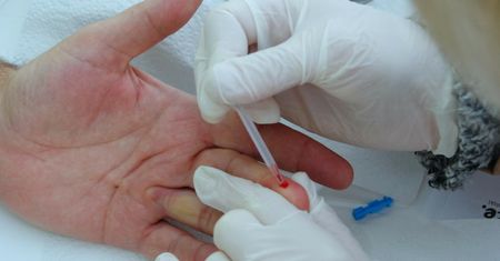 "Cichy zabójca". 120 tys. Polaków nie wie, że jest zakażonych. Choroba wyniszcza wątrobę, prowadzi do raka
