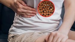 Nowy czynnik ryzyka dla wątroby. Tworzy podatny grunt dla nowotworu