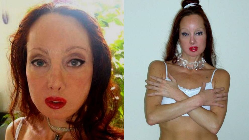 Pragnie upodobnić się do antycznej władczyni. Przeszła 51 operacji, na które wydała ponad 1 mln złotych