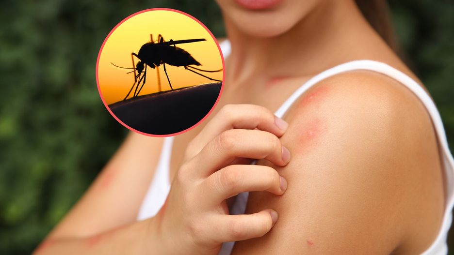 Komary szczególnie cię lubią? Wystarczy zmienić mydło