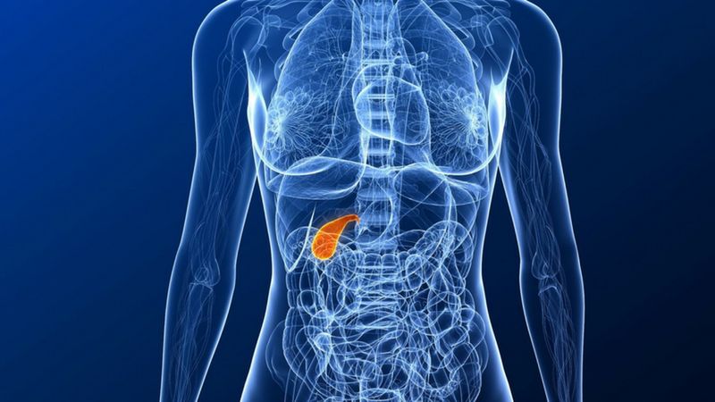 Kamica żółciowa może być niebezpieczna dla życia chorej osoby