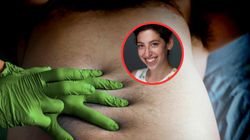 Przeszczepili im mikrobiotę jelitową. Nieoczekiwany skutek procederu