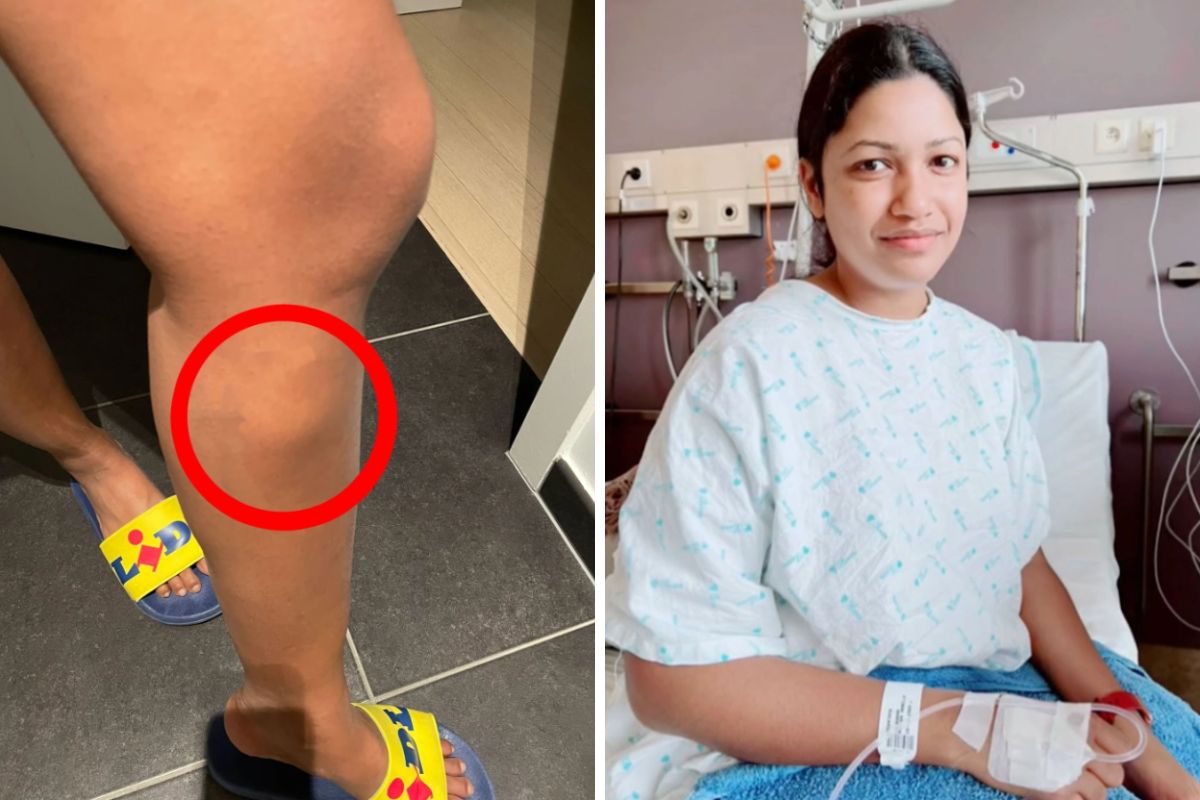 Zaczęło się od niewinnie wyglądającej pokrzywki