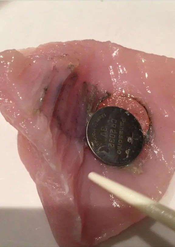 Bateria może dosłownie wypalić dziurę w przełyku 