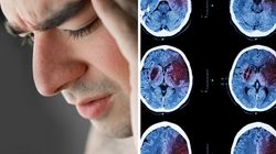 Cichy udar mózgu. Oto 10 sygnałów, które to potwierdzą i ostrzegą cię przed kolejnym