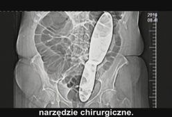 Rażące niechlujstwo lekarzy prawie ją zabiło