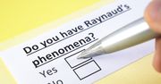 Objaw Raynauda - co to jest, jak powstaje i co oznacza? Choroba Raynauda i zespół Raynauda