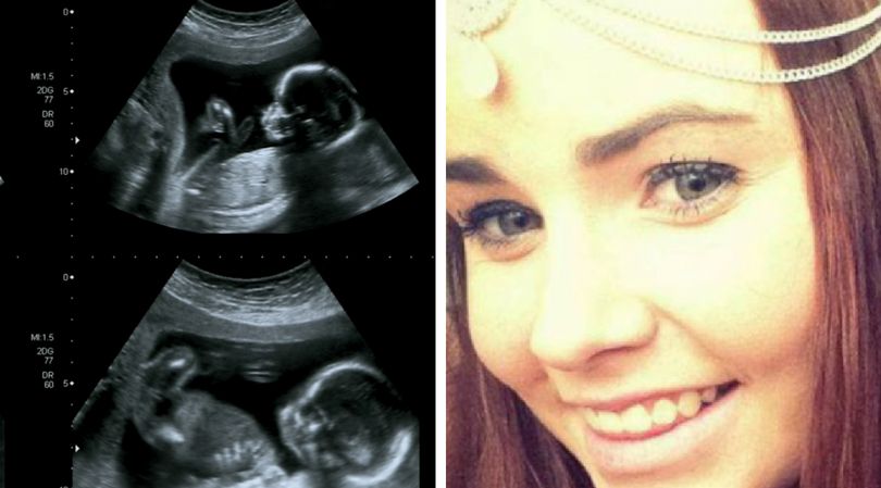 Megan Walsh była w 4 miesiącu ciąży