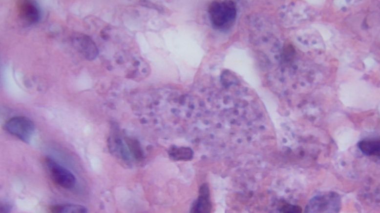 Leishmania to pasożytnicze wiciowce, które wywołują chorobę tropikalną, leiszmaniozę. 