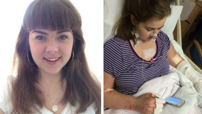 21-letnia Charlotte Hannibal w wyniku doznania zapalenia opon mózgowych, została trwale niepełnosprawna 