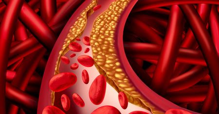 Produkty, które podwyższają poziom cholesterolu (WIDEO)