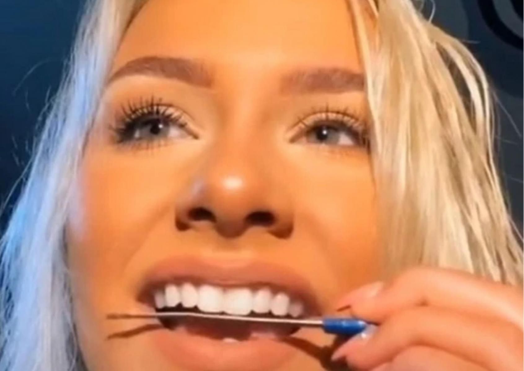 Lekarze ostrzegają przed niebezpiecznym trendzie na TikToku