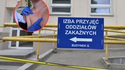 Już 26 przypadków odry w jednym województwie. "Tylko iskra padnie i będzie epidemia"