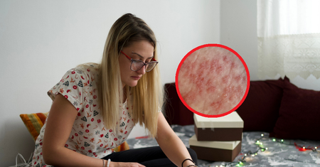 Zauważysz podczas pakowania prezentów. Mogą wskazywać na raka