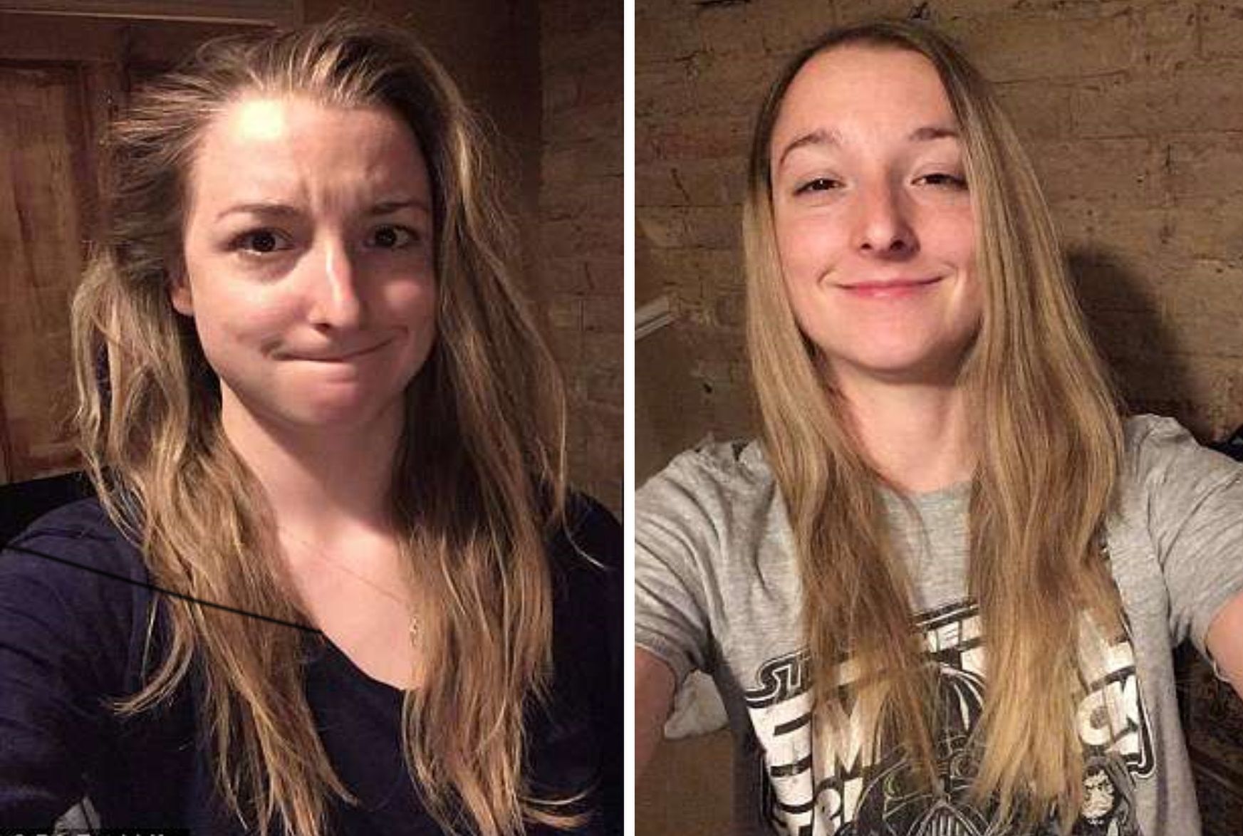 Emma cieszy się, że ma teraz piękne, zdrowe i gładkie włosy 