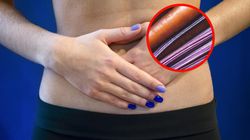 Błonnik, który działa jak opatrunek dla jelit. Znajdziesz go w buraku, marchewce