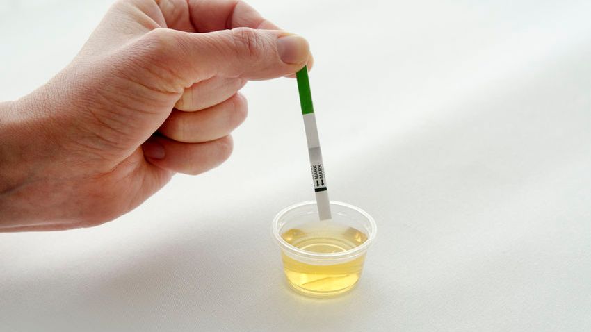 Jak zrobić test owulacyjny?