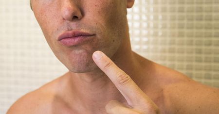 Opryszczkę można i trzeba leczyć. Przy niskiej odporności może być bardzo groźna
