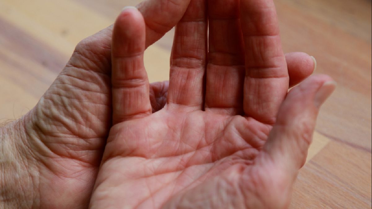 Zwróć uwagę na dłonie. Ważny sygnał, ze jesz za dużo soli