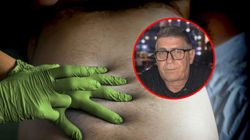 Jest pierwszym takim pacjentem w Polsce. Opowiada, co doprowadziło do czterech przeszczepów wątroby