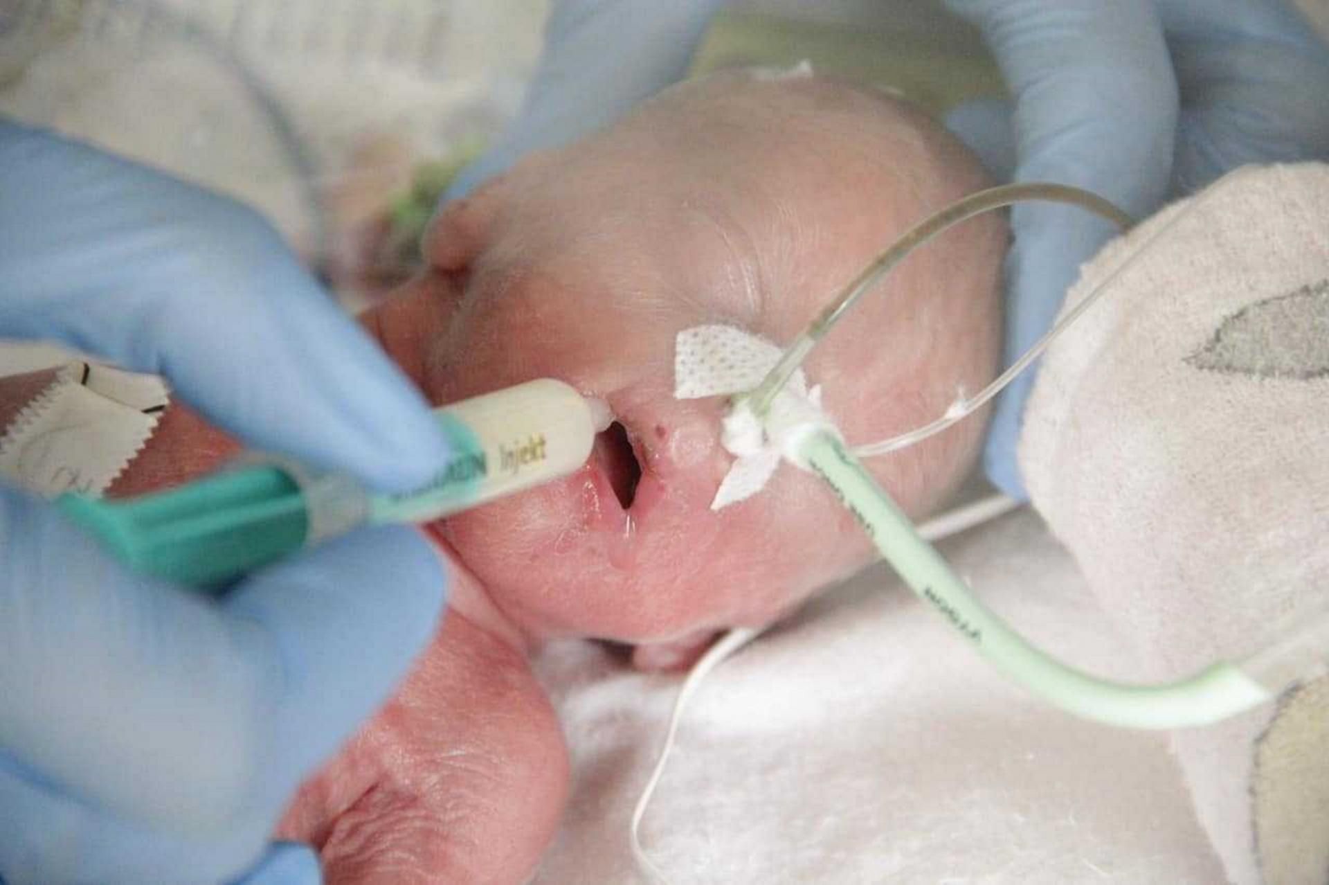 Jaś był skrajnym wcześniakiem