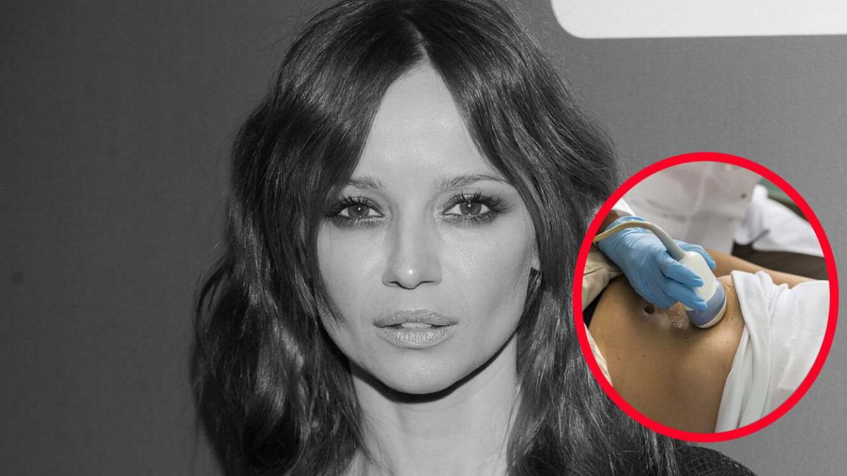 Objawy śmiertelnego raka dostrzeżesz na skórze. Lekarz alarmuje