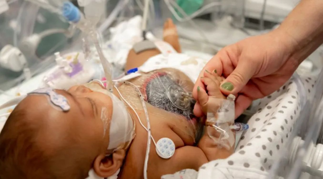 AmieLynn po operacji