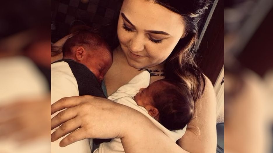 Urodziła bliźnięta, które mają inny kolor skóry